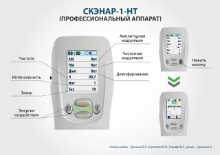 СКЭНАР-1-НТ (исполнение 01)  в Иркутске купить Нейродэнс ПКМ официальный сайт - denasdevice.ru 